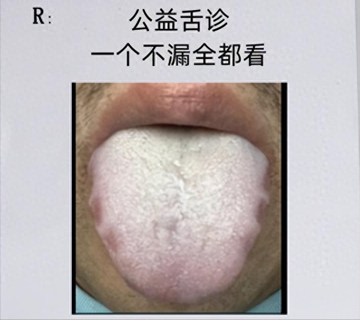 A few dollars of Huoxiang Zhengqi is comparable to a vacuum 